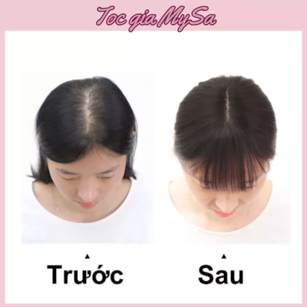 Tóc giả phủ hói 3D mái thưa siêu lưới giúp phủ hói đỉnh đầu cho nữ, có thể sử dụng nhiệt