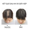 Tóc giả che hói mái thưa 4D rãnh da đầu, phủ hói đỉnh đầu cho nữ, mái giả phủ hói Hàn Quốc
