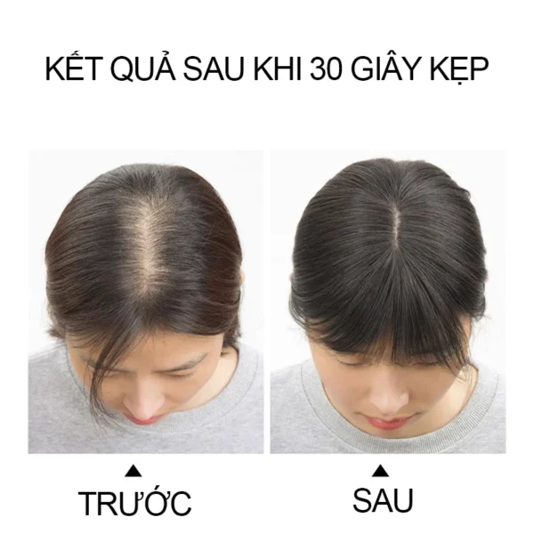 Tóc giả che hói mái thưa 4D rãnh da đầu, phủ hói đỉnh đầu cho nữ, mái giả phủ hói Hàn Quốc