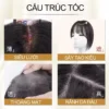tóc mái thưa phủ hói siêu lưới 5D tóc thật 100%, tóc giả che hói mái thưa có rãnh da đầu