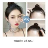 Mái dán che hói chữ M được làm từ 100% tóc thật, tạo được nhiều kiểu mái đa dạng